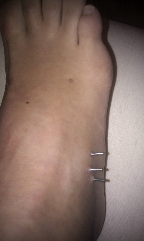 lp131104001.jpg