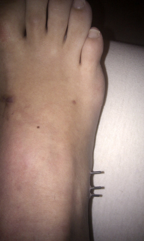 lp131104002.jpg