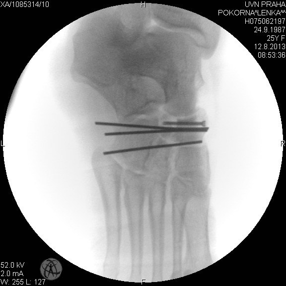 lp131104005.jpg